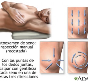 zuga_cancer_de_mamas