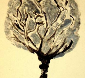 zuga-7-cosas-raras-que-hacer-con-la-placenta