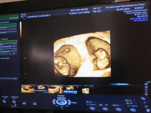 cómo quedar embarazada