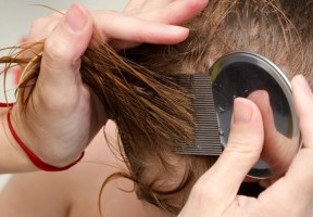 zuga-que-hacer-cuando-tu-hijo-tiene-piojos