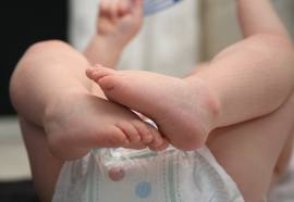 circuncision de tu hijo